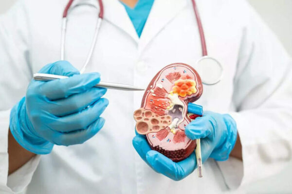 What causes kidney attacks: Understanding its symptoms and ways to protect your kidneys |