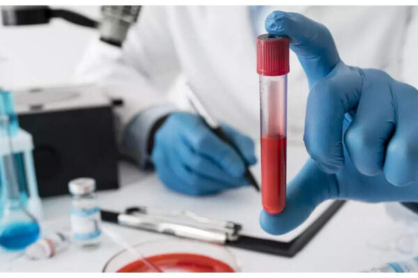 The 3 simple tests that can literally ‘save’ one’s life, as per Stanford trained doctor