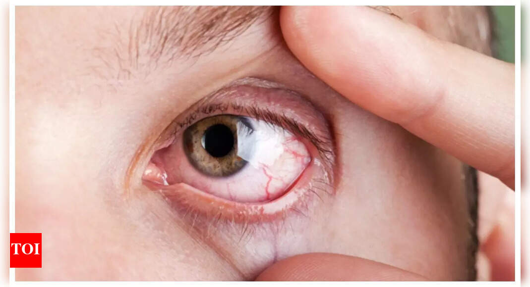 Eye Rubbing: This simple, everyday habit can damage one’s vision (and what should one do about it) |