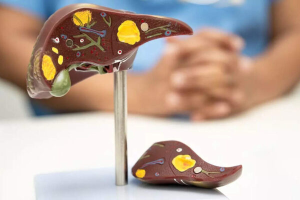 Harvard-trained doctor reveals 8 vegetables that boost liver detox and gut health naturally |