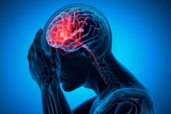 The first 90 days after stroke: Why they define the rest of your life