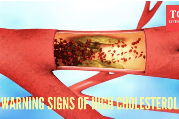 5 warning signs of high cholesterol in the body, and what causes it