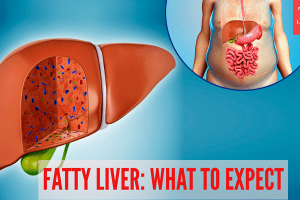 4 stages of fatty liver disease explained: Symptoms, risks, and recovery