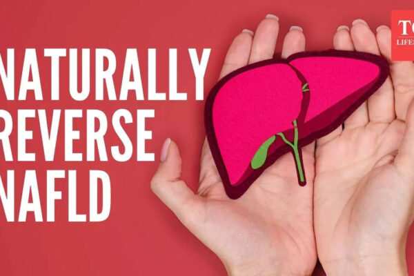 Reverse fatty liver naturally in 90 days: Here are 3 things to focus on