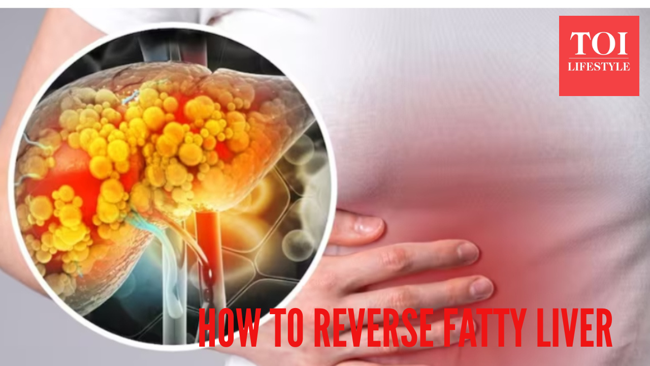 5 ways to help reverse Grade 1 Fatty liver in 60 days