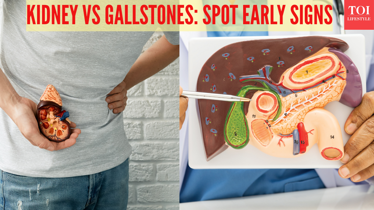 Gallstones vs Kidney Stones: Causes, differences, and key symptoms