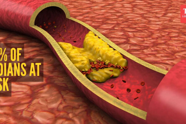 5 silent signs of high cholesterol one might miss