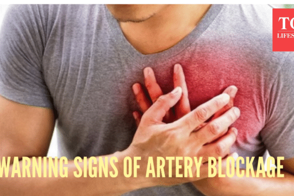5 early symptoms that signal arterial blockage