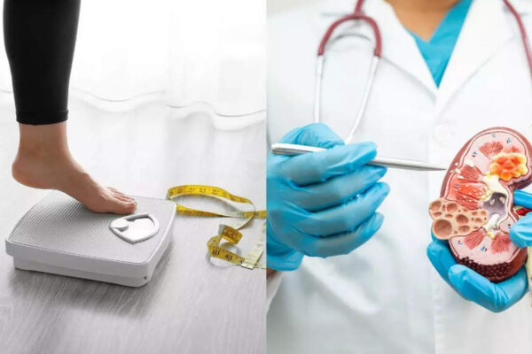 Can sudden weight gain or weight loss damage your kidneys? Know about renal function decline and risk factors |