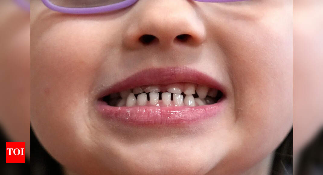 Fluoride Supplement: FDA has restricted this common supplement given to growing children due to major health concern |