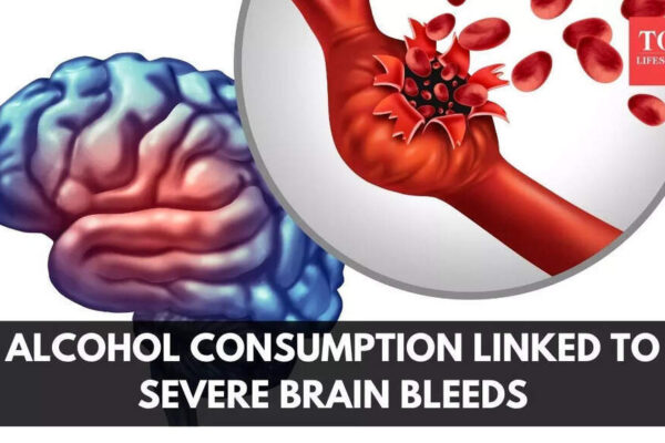 Not just a hangover: Alcohol consumption linked to severe brain bleeds, study finds