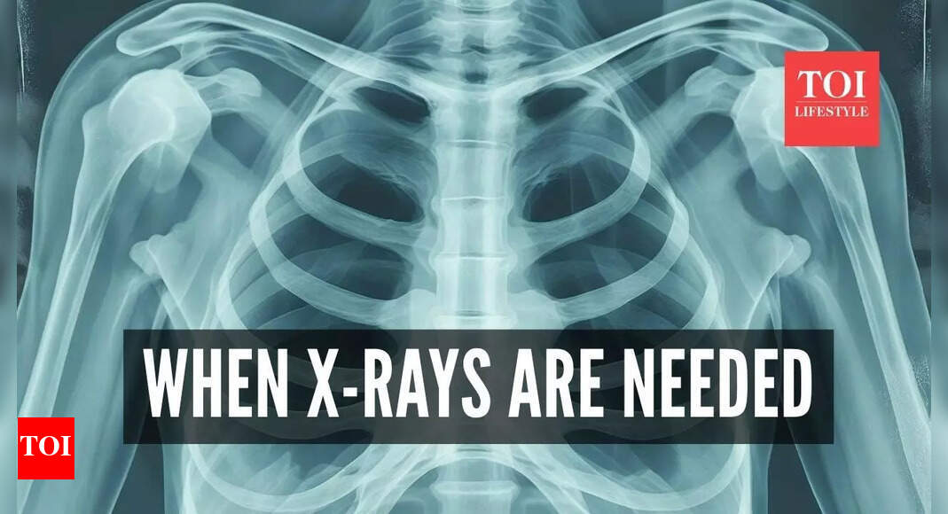 Top neurologist warns, ‘stop routine chest X-rays’: Here’s when they’re actually needed |