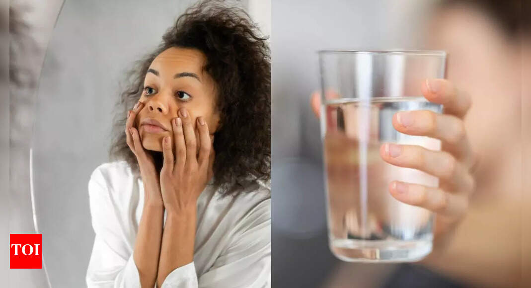 Drinking less water could be making your dark circles worse; here’s why |