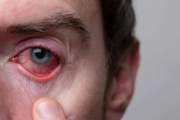 10 hidden health risks your eyes reveal before symptoms appear: Early signs you might be overlooking and prevention tips