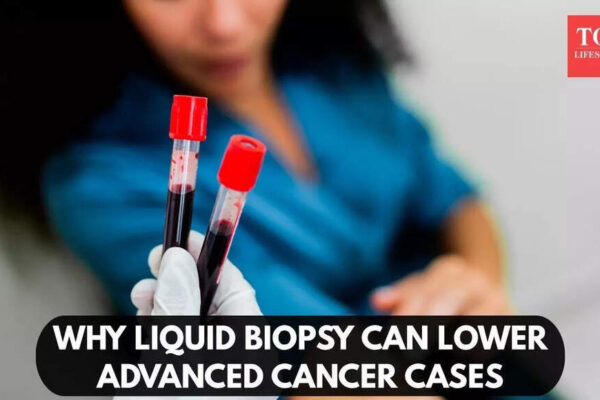 Forget painful procedures: This simple blood test could catch cancer before it starts |