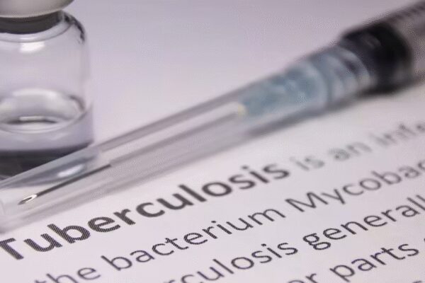 India sees 21% dip in TB cases but has 25% of new patients globally | India News