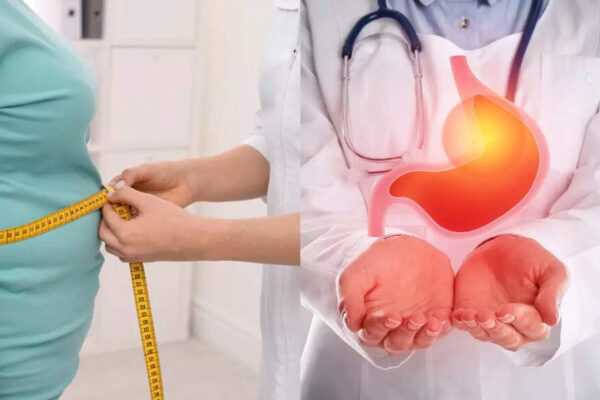 Obesity increases the risk of stomach cancer: Understanding the link between excess weight and digestive health |