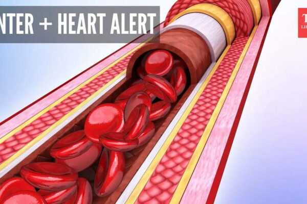 Arteries naturally constrict in winter and can cause high BP, heart attack: 5 things to do to stay safe |
