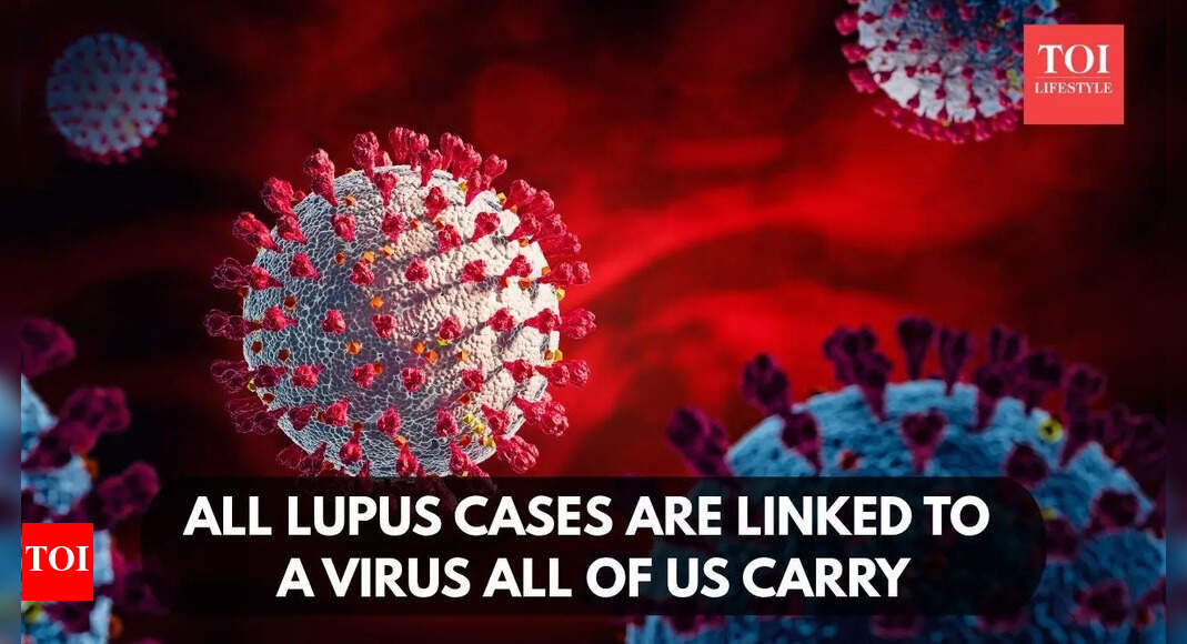 All lupus cases are linked to a virus all of us carry, study finds |