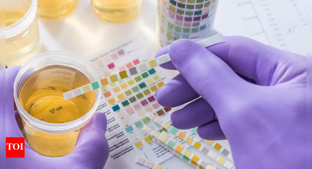 What does the colour of your urine say about your health |