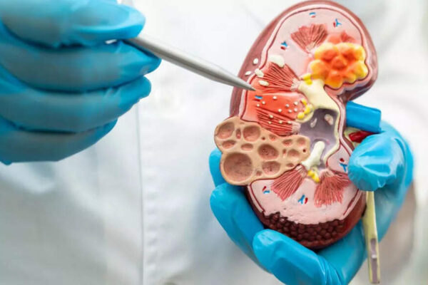 Understanding high creatinine levels: Causes, symptoms, and what they reveal about your kidney health |