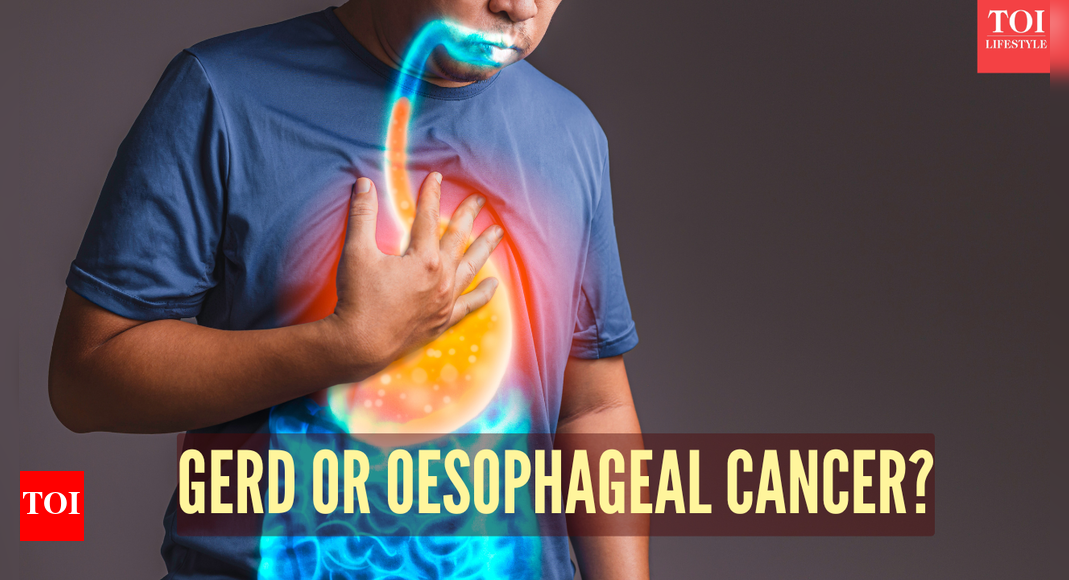 Esophageal cancer vs GERD: Symptoms, causes, and key differences |