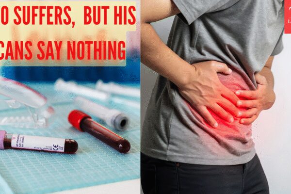 CT scan, blood work showed nothing, yet a 13-year-old struggled with stomach pain, Apollo doc decodes the mystery disease