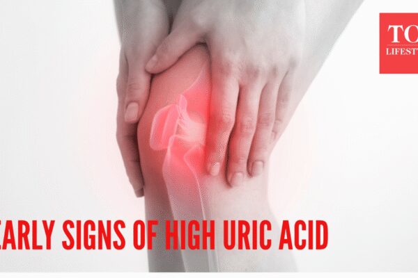 5 early symptoms of high uric acid that can occur before a gout attack