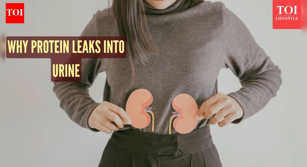 Top 5 causes of protein in urine and kidney stones, according to top Nephrologist