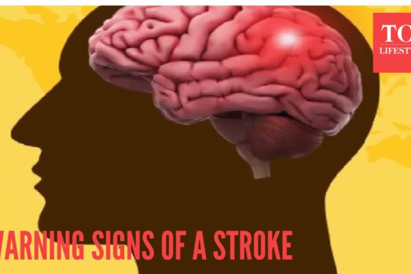 5 warning signs of a stroke that can occur a month before
