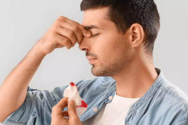 Why nosebleeds are more dangerous for patients with high blood pressure or on blood thinners |