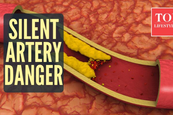 5 major causes, and ways to prevent it
