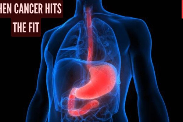 No smoking, no alcohol: The hidden reason behind how a fit 30-year-old got diagnosed with esophageal cancer