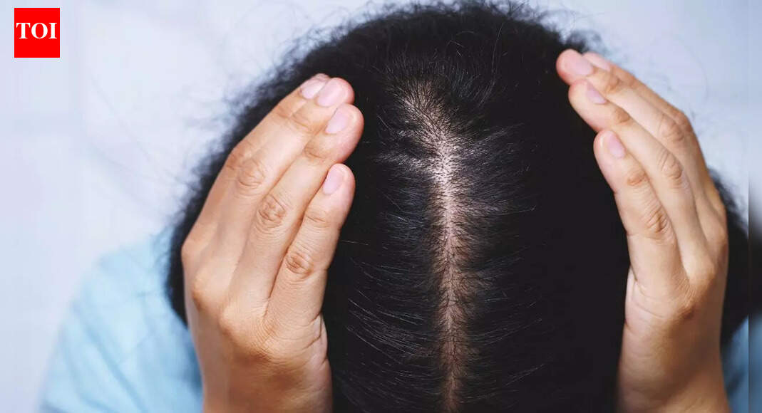 7 Home remedies for dry scalp in winter: Natural solutions to hydrate, soothe, and reduce flakes |