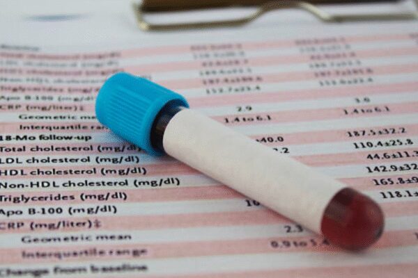 “Cholesterol is only a part of the equation”: Doctor reveals hidden dangers and the plot hole no one notices