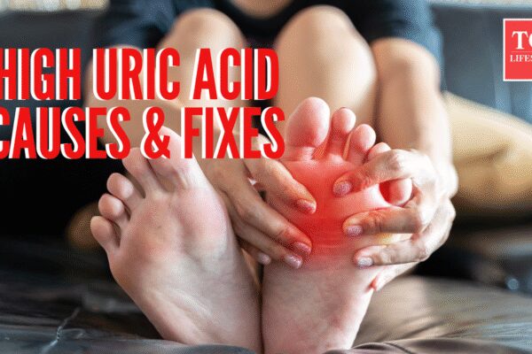 What causes high uric acid levels, early symptoms and how to bring it down naturally with science backed tips