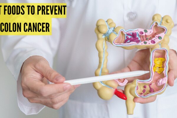 5 research-backed foods that may help lower your risk of colon cancer
