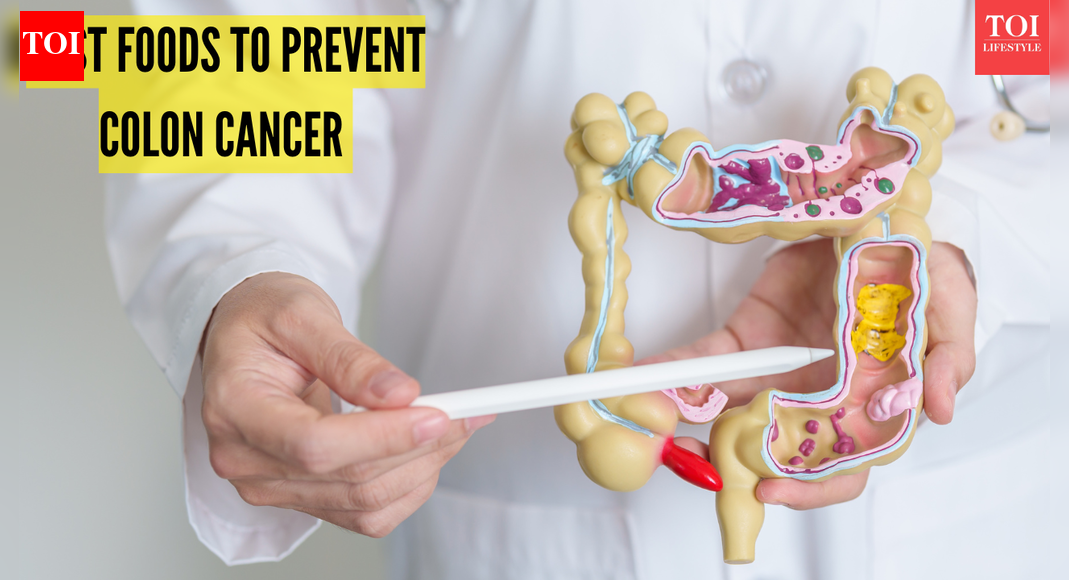 5 research-backed foods that may help lower your risk of colon cancer