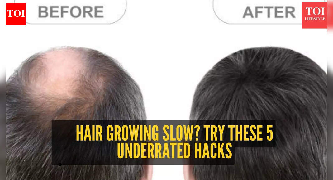 5 hair growth hacks no one told you about