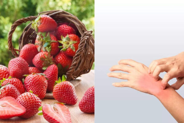 Can strawberries cause allergies: Know the signs, causes, and how to manage them |