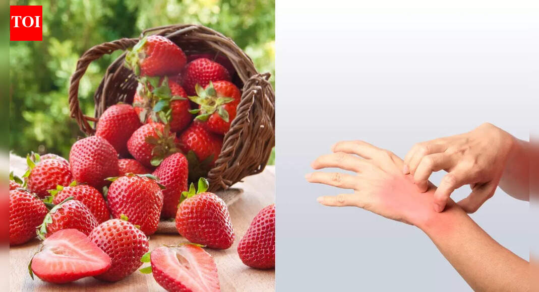 Can strawberries cause allergies: Know the signs, causes, and how to manage them |
