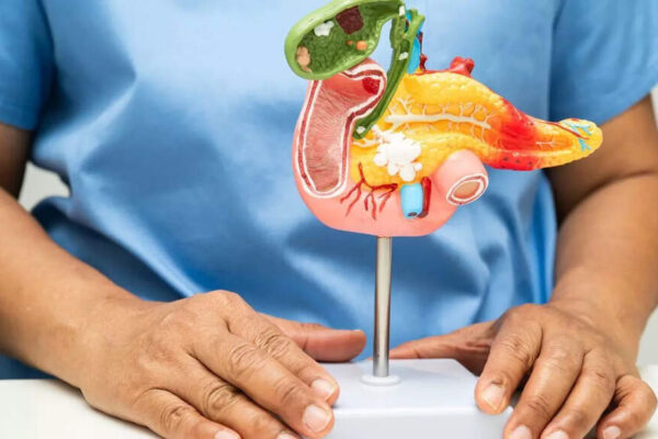 This everyday food could be raising your pancreatic cancer risk and affecting your health |