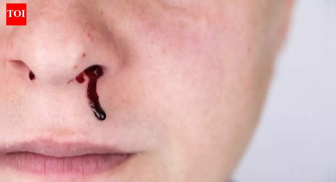 Why your nose bleeds when you sneeze and how to stop it: Common causes, risks and treatment |