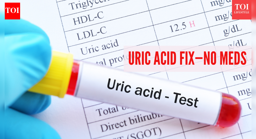 High uric acid doesn’t need medication, says a , and this is what he recommends instead