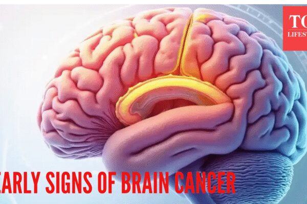 5 signs of early brain cancer that go unnoticed