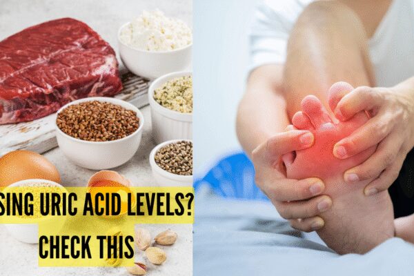 High Uric Acid: No red meat, no alcohol: What else could be driving your uric acid up? |