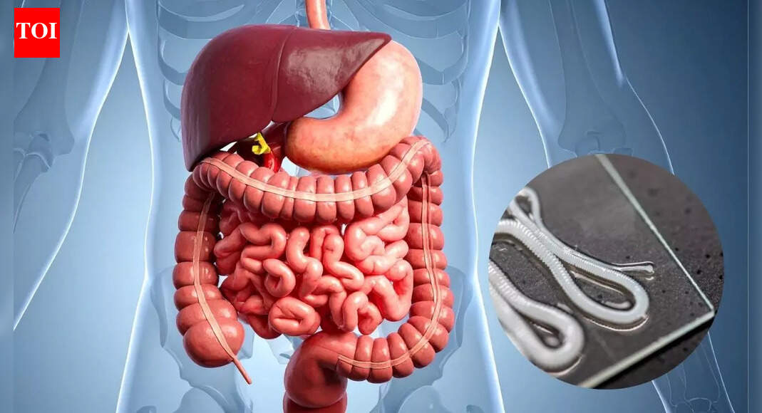 Spotting worms in your poop: How to identify the types, causes, and symptoms |