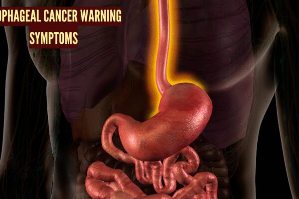 4 early warning signs and symptoms of esophageal cancer