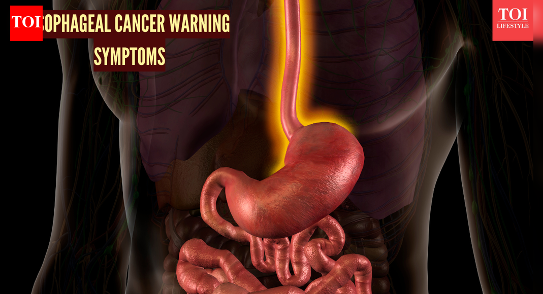 4 early warning signs and symptoms of esophageal cancer