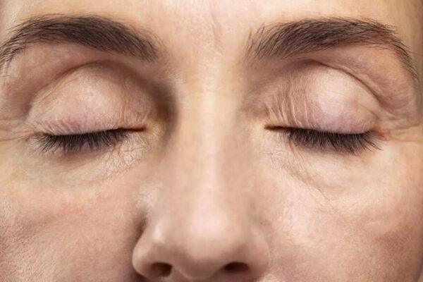 What your eyelashes say about your overall health: 4 conditions you should never ignore |